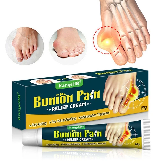 20 g crema antidolorifico Arching Bunion 20 g crema antidolorifico punta dolore salute rigida DE