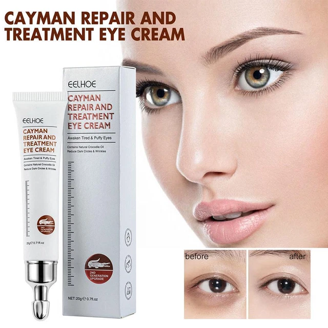 Reparación de arrugas crema para ojos esencia firme bolsa para ojos línea de ojos reparación de círculo negro