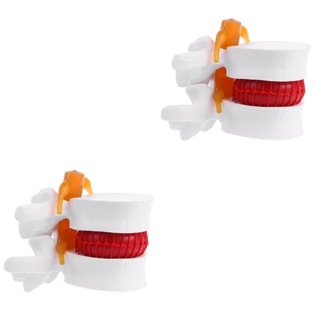 2 Pcs Human Lumbar Spine Model Body Manikin Intervertebral Disc