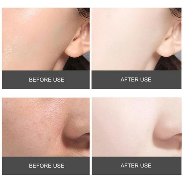 Paquete de té verde aceite de limpieza facial acné espinillas control de limpieza profunda U2W0