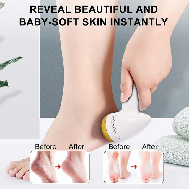 Smerigliatrice per piedi File dei piedi Pelle morta dura Rimozione pedicure