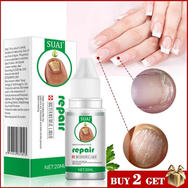 Nail Treatment Foot Repair Essence Toe Nail Fungus Removal Gel Anti Infection