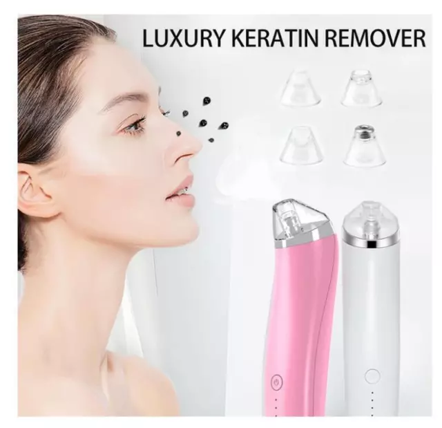 Luxury Confidence Keratin Remover, Blackhead Remover Electric Pore Vacuum