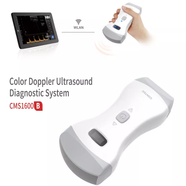 Handheld  Color Doppler Ultraschall Scanner, Convex&Linear Probe