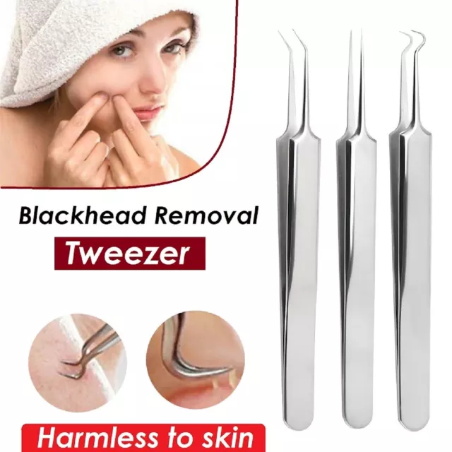 Blackhead Remover Tool Acne Clip Needle Tweezers Blemish Pimple Popper Extractor