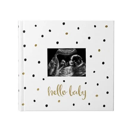 Pearhead Baby Photo Album, Baby Book Keepsake for New and Expecting Parents,