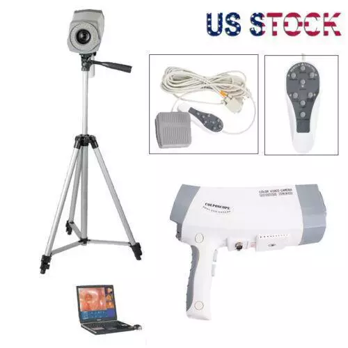 Portable Gynaecology Medical Electronic Colposcope Digital CCD Colposcopy