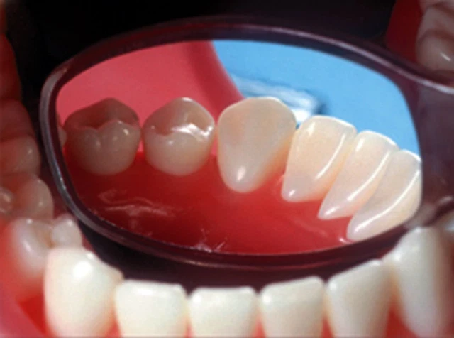 Flecta Disposable Mouth Mirrors - Box of 200