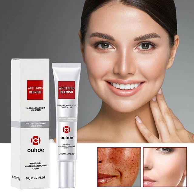 Crema blanqueadora para eliminar manchas oscuras crema facial hidratante antipecas
