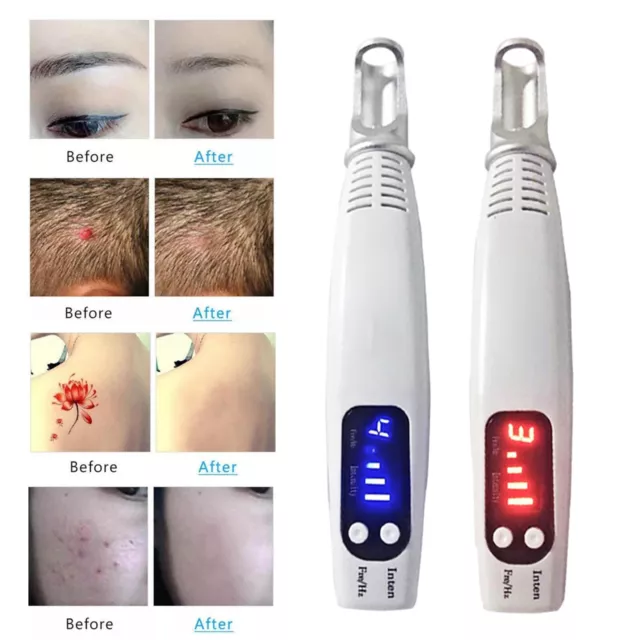 Pluma de eliminación de tatuajes con láser Picosegundo para manchas oscuras lunares cicatrices de acné