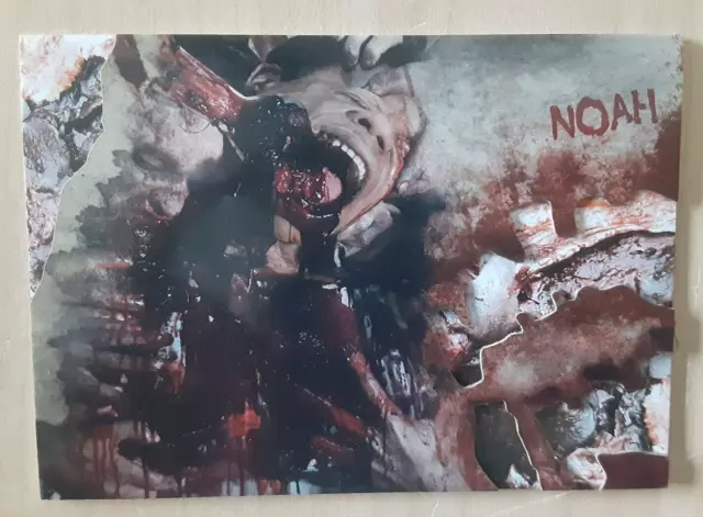 2016 Topps The Walking Dead Survival Box Walker Bite Noah #5 parallel card x/25