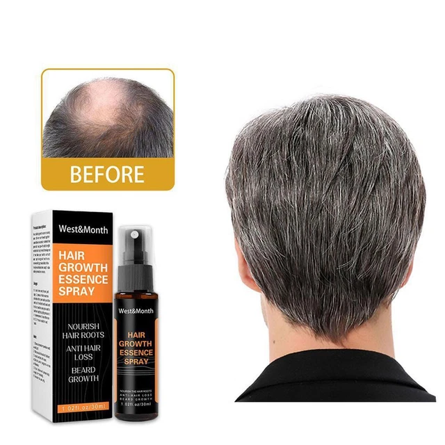 30 ml He Shou Wu tratamiento antipérdida de cabello spray líquido para el cabello jengibre anticabello N3K9