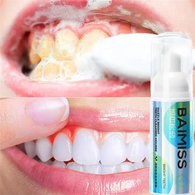 Pasta de dientes de limpieza Mou-sse higiene oral elimina manchas de placa