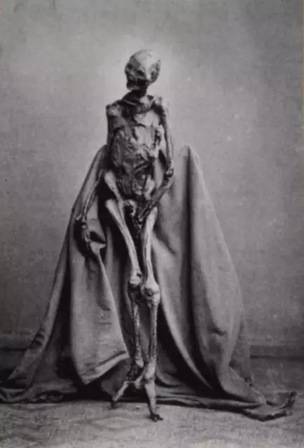 Antique Skeleton Photo 746b Odd Strange & Bizarre