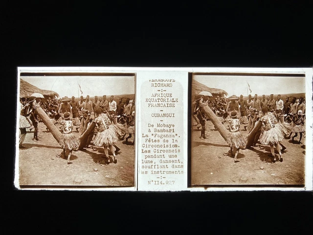 CIRCUMCISION OUBANGUI GLASS PLATE 45x107 STEREOSCOPIC VIEW VERASCOPE RICHARD