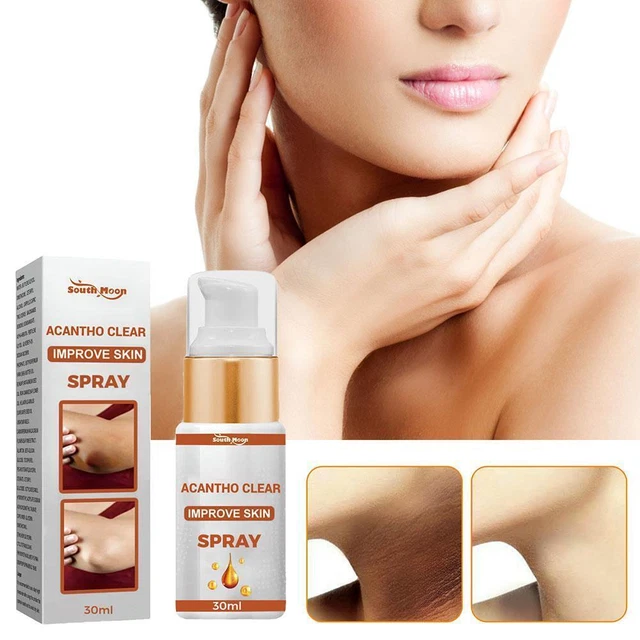 GFOUK Spray terapia acantocleare, olio terapia acanthosis nigricans Regno Unito