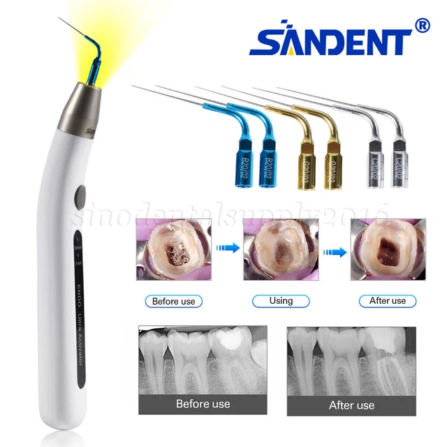 Endo 1 attivatore irrigazione endocanalare Woodpecker – Blu Dental