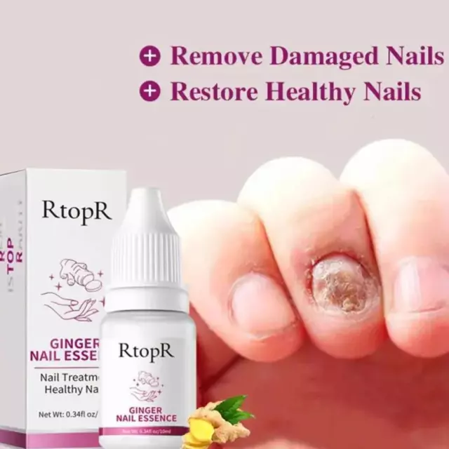 Ginger Antibacterial Nail Treatment Essential Anti Nursing UK 2023 D7U7 A