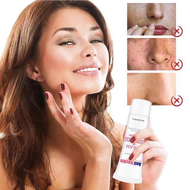 Lote de Crema Blanqueadora de Pecas Puntos Negros Pecas Brillar Piel Nutritiva J6