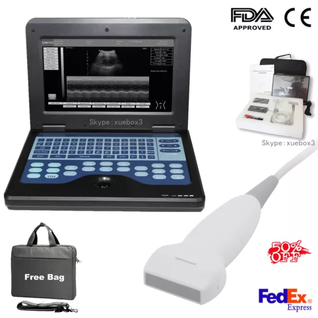CMS600P2 Digital Medical Laptop Ultrasound Scanner machine W/ Linear Probe,FedEx
