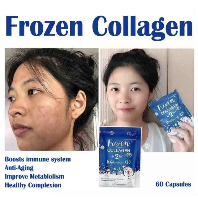 Frozen Collagen Youthful Skin Whitening AntiAcne Mineral Vitamin Rich Supplement