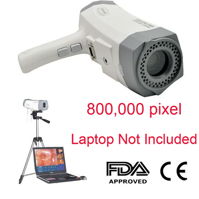 Carejoy RCS-400 LED Electronic Colposcope Video Carema 800,000 px+Tripod Newest