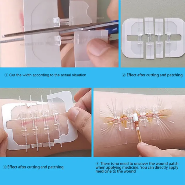 New Body Skin Glue Medical Adhesive Liquid Bandage Wounds First Aid UK