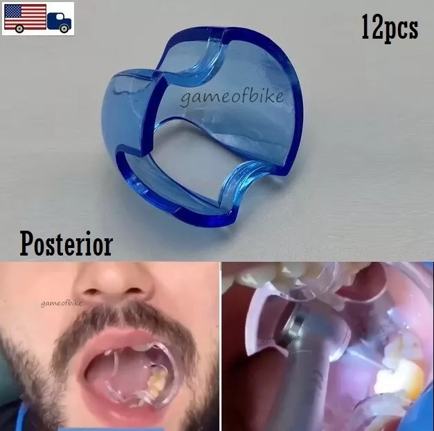 Dental Endodontic Mouth Opener Lip Cheek Retractor Expander Bite Props Posterior