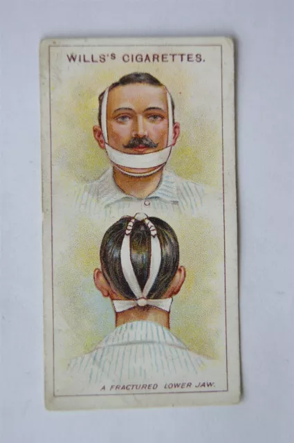 1913 Wills First Aid No. 2 Fractured Jaw (with clause)