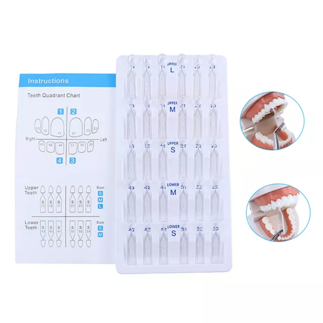 30Pcs/Kit Dental Composite Resin Veneers Mould Light Cure Anterior Front Teeth