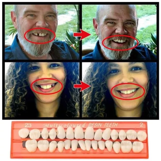 Care Temporary Crown Tooth Tool Resin Acrylic Teeth Veneers Simulation Teeth