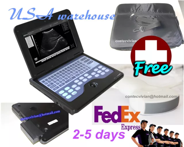 Portable Ultrasound Scanner Diagnostic System Ultrasonic Machine Probe CMS600P2