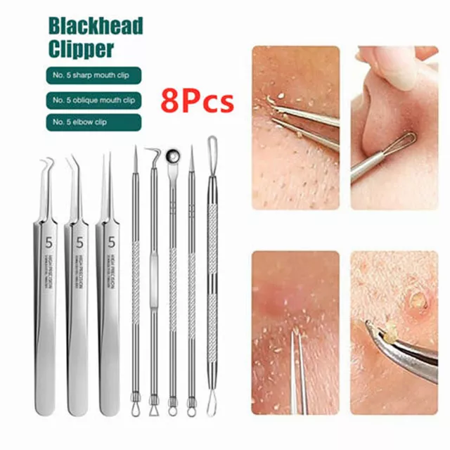 8X Blackhead Remover Pimple Popper Tool Kit Spot Acne Comedone Extractor Remover 2