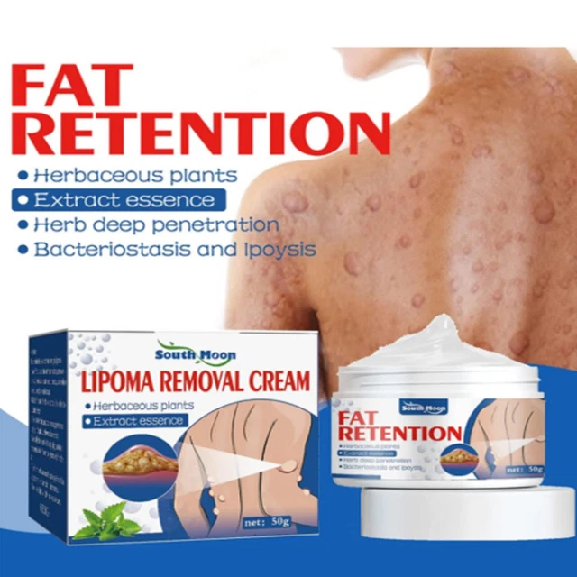 INSTANT LIPOMA REMOVAL Cream,LumpFree Lipoma Removal Creams 50g FAST