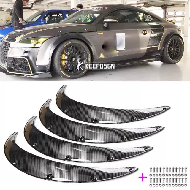 35" Carbon Look Fender Flares Wheel Arches Widebody JDM Kit For Audi TT RS A3 A4