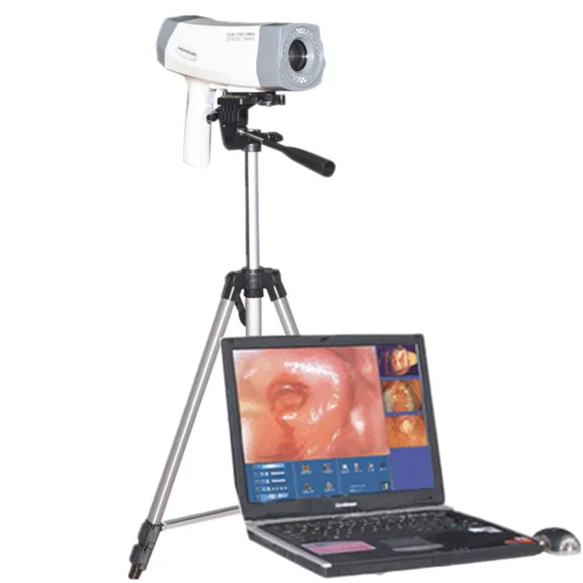 Carejoy Digtal Colposcope Vaginoscope Video Color  Camera 480000pixels +Tripod