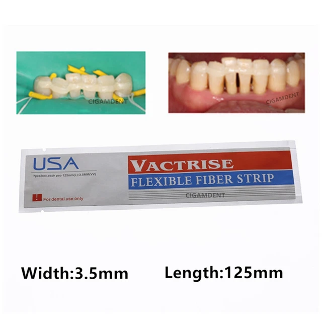 DENTAL GLASS FIBER Splint Light Cure Composite Resin Bonding Strip