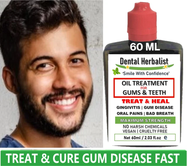 NATURAL PURE HERBAL OIL Gum & Dental Disease FAST Reverse Receding Gums