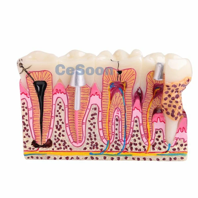 6-times-dental-summers-comparison-anatomy-teeth-dental-laboratory-model