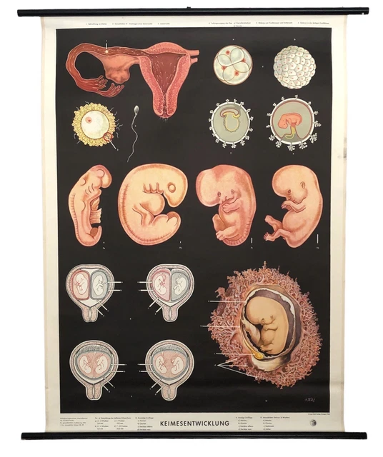 Schulwandkarte Rollkarte Keimesentwicklung vintage Lehrkarte Anatomie Klett