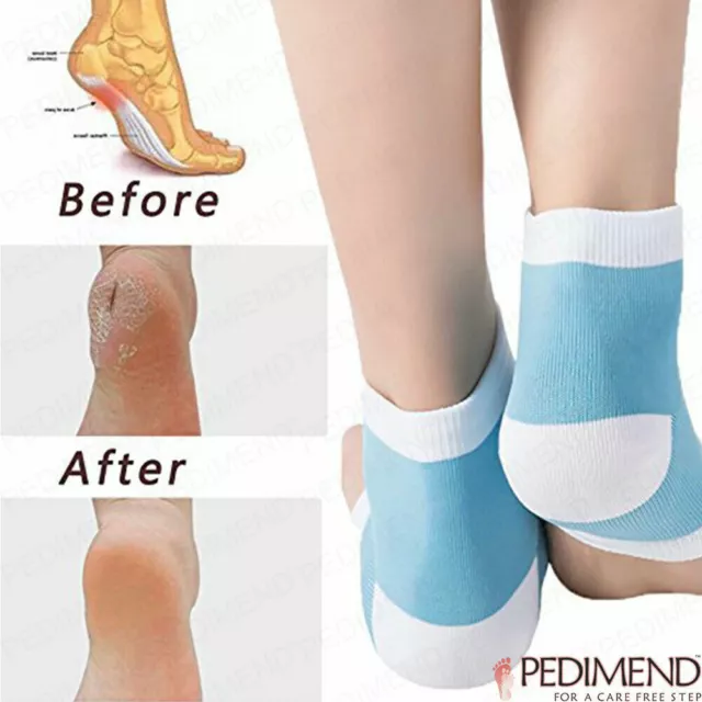 Pedimend Back Foot, Ankle, Achilles Care, Heel Protector Moisturizer Socks-1PAIR