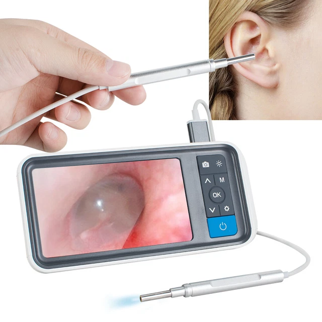Kit de eliminación de cera de orejas con endoscopio LED para cámara de oído kit de limpieza de cera para oídos