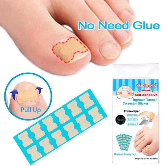9-teiliges Nagelhautstäbchen-Set Mit Bimsstein – Nagelhautentferner Für Maniküre & Pediküre