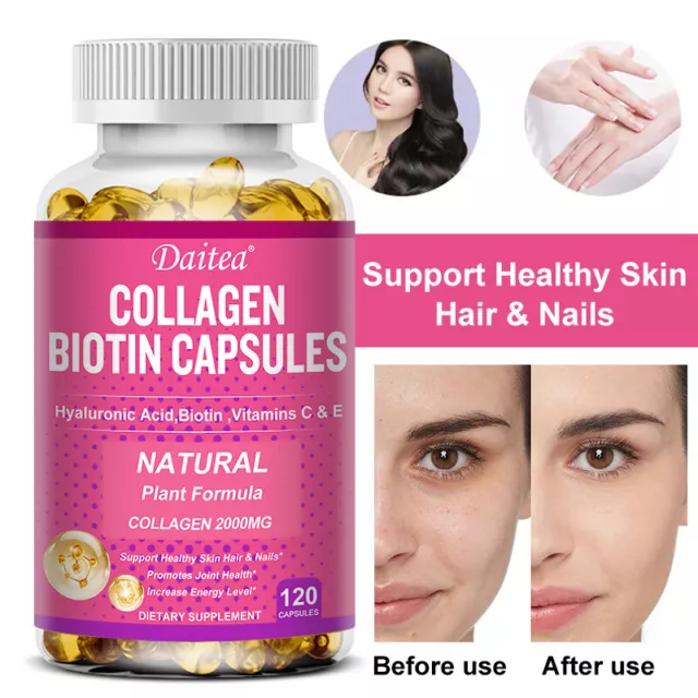 Collagen Biotin Capsules Contain Hyaluronic Acid, Biotin, Vitamins C and E