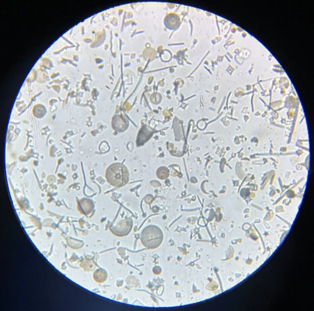 J.D. Moller Microscope Slide Diatom Fossil Moron Earth Spain Gold Medal 1869