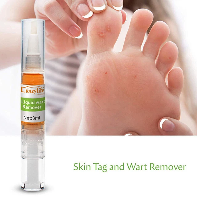 Skin Tag Remover Pen 12 hours Tu kill Tu kill Remover Skin Tag Mole & Genital ql