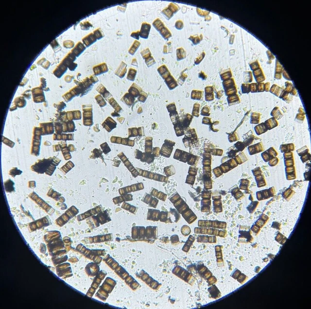 19th c J.D. Moller Microscope Slide Diatom Slovakia Melosira Borrerii Grev.