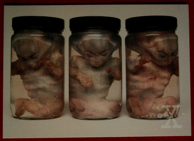 X-FILES - SEASON ONE - Card #63 - EXTRA-TERRESTRIAL EMBRYOS - Topps - 1996
