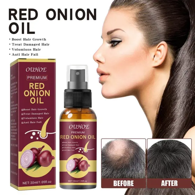 Olio per capelli di cipolla | controllo crescita e caduta capelli cura naturale 10/30 ml capelli L2Y8