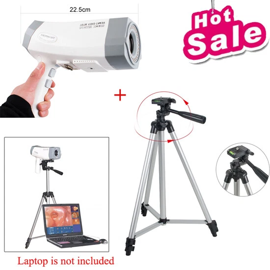 Carejoy RCS-400 Color Digital CCD Electronic Colposcope 480,000 pixels FDA